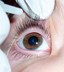 Estados Unidos: Colírios contaminados causam 4 mortes